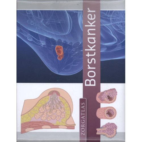 Esculaap Media Borstkanker Zorgatlas Maria Bruins esculaap media kopen in de aanbieding